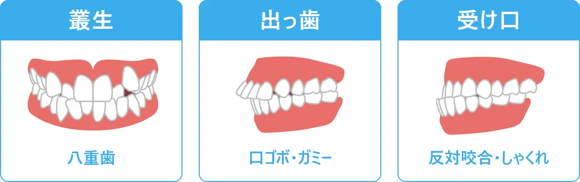 多くの歯並びに対応できる